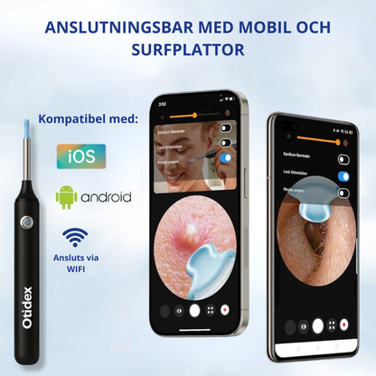 Otidex™